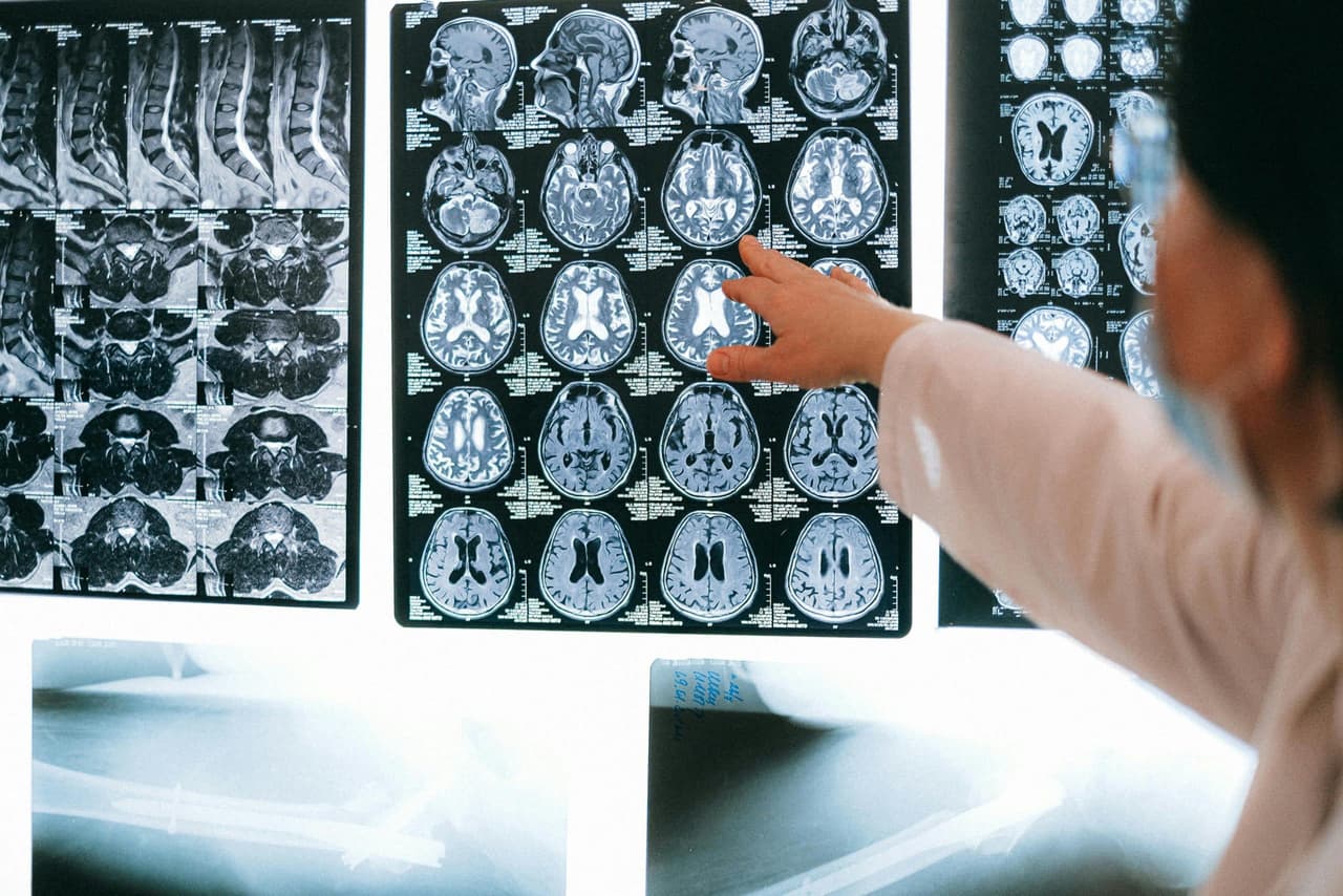 What Does Xanax Do to the Brain? Understanding Its Effects and Risks